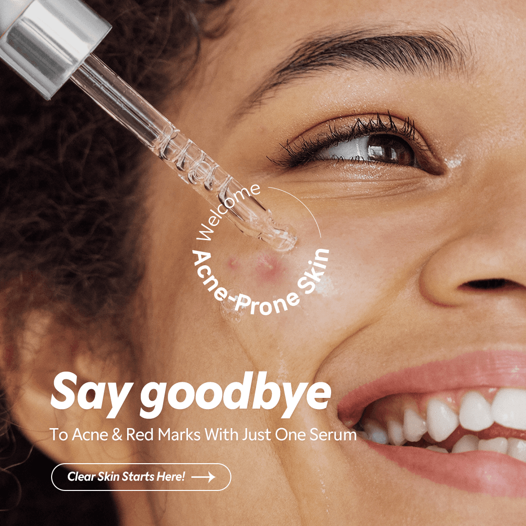 Azelaic Acid 12% Serum - image 2